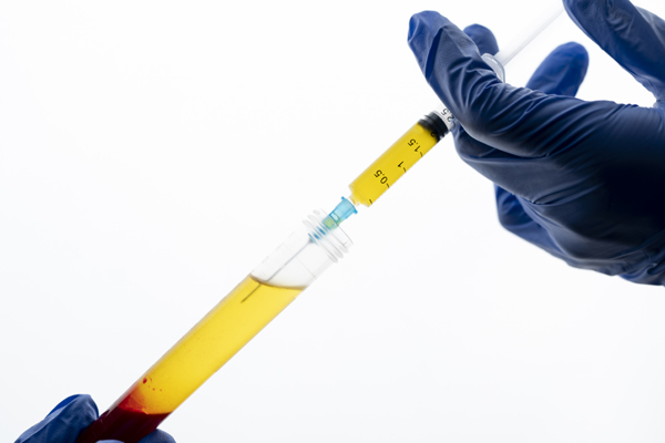Hepatitis B Test